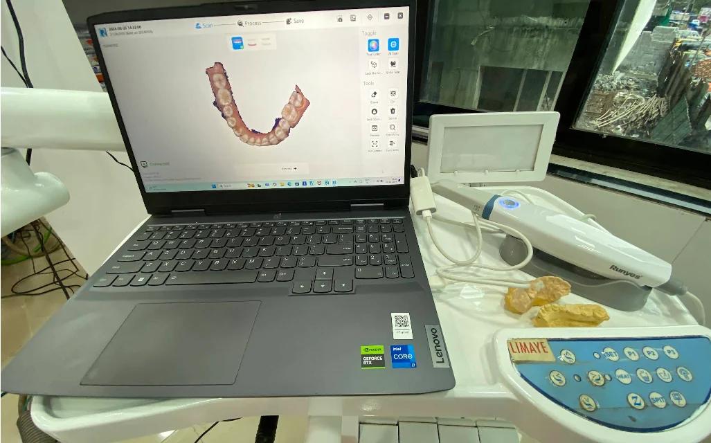 Digital dental scan